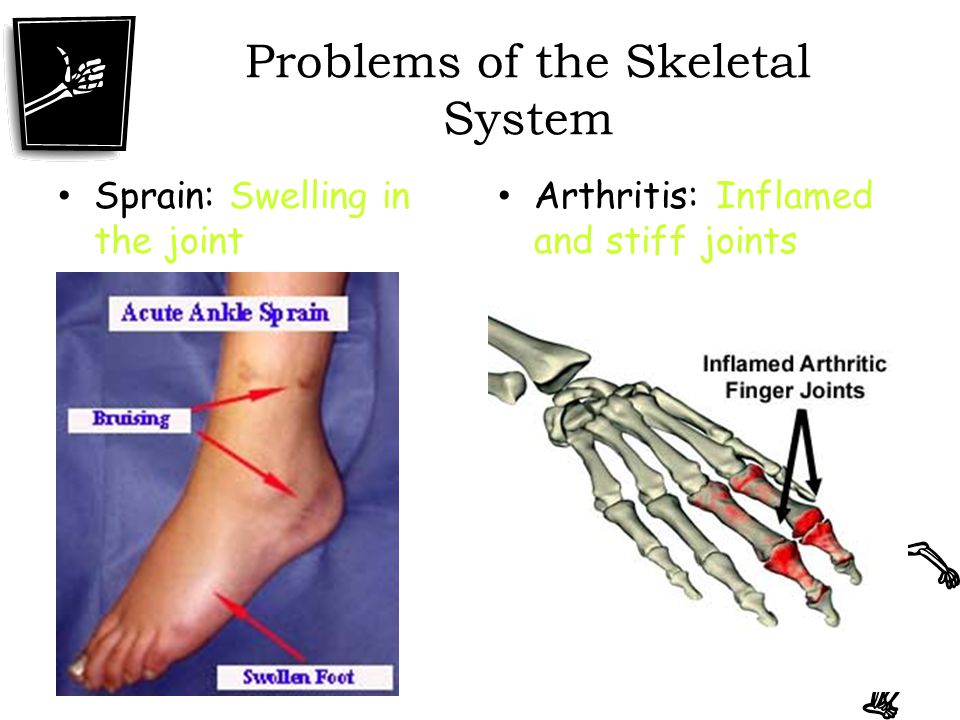 Problems of the Skeletal System