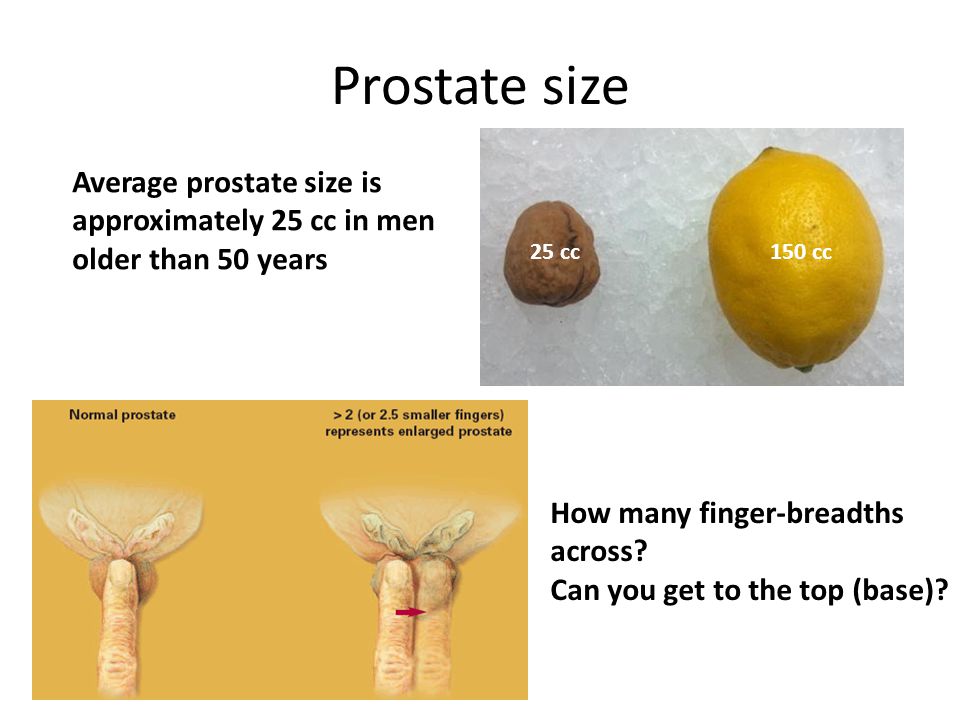 what is normal prostate size in cc)