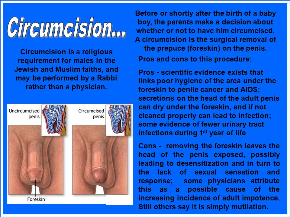 Can Circumcision Ruin Your Sex Life
