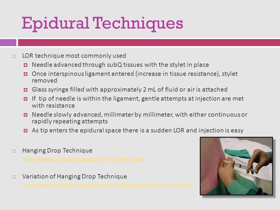 Neuraxial Anesthesia: Spinal epidural Caudal - ppt download