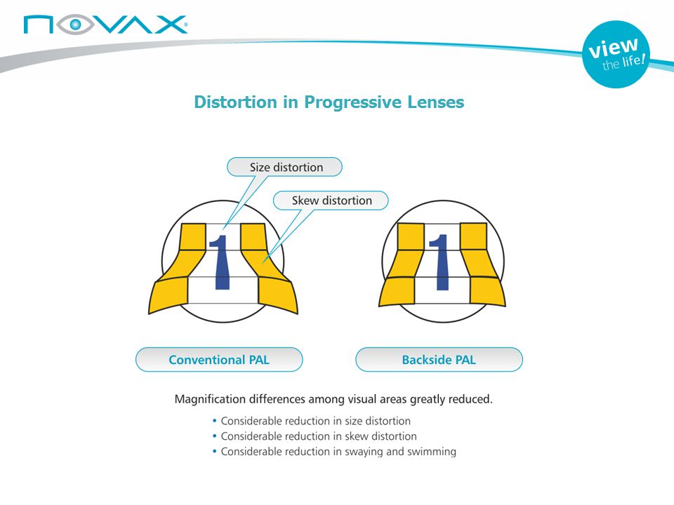 Distortion in Progressive Lenses