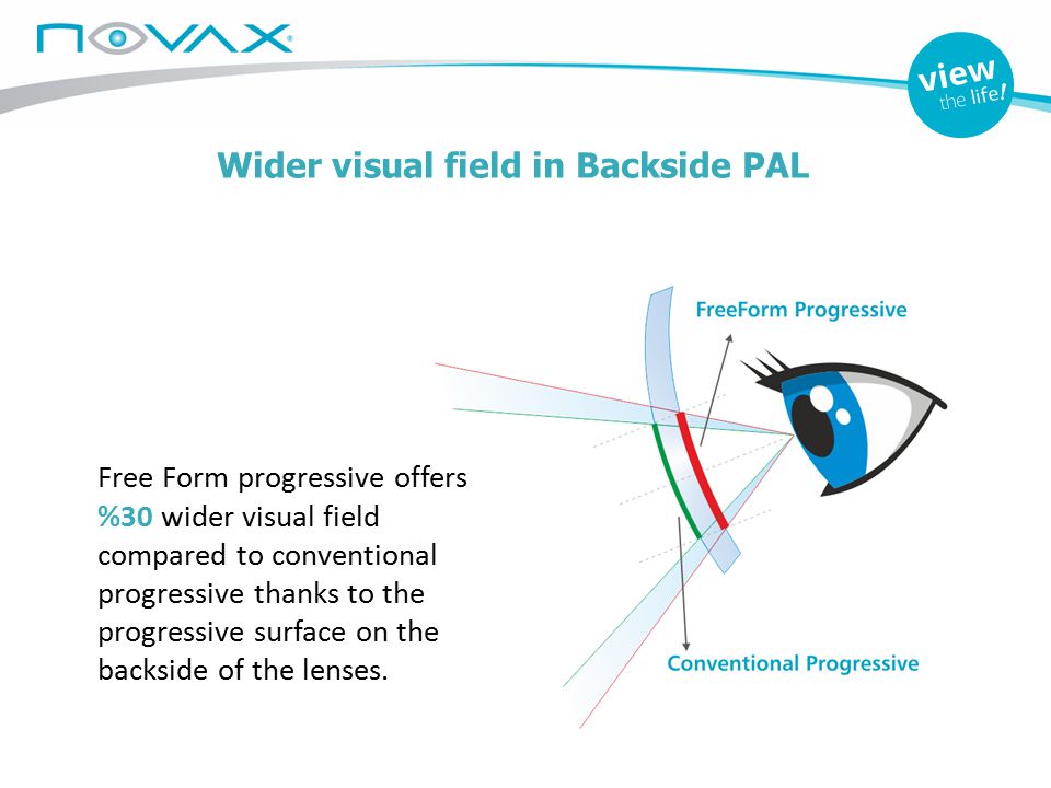 Wider visual field in Backside PAL