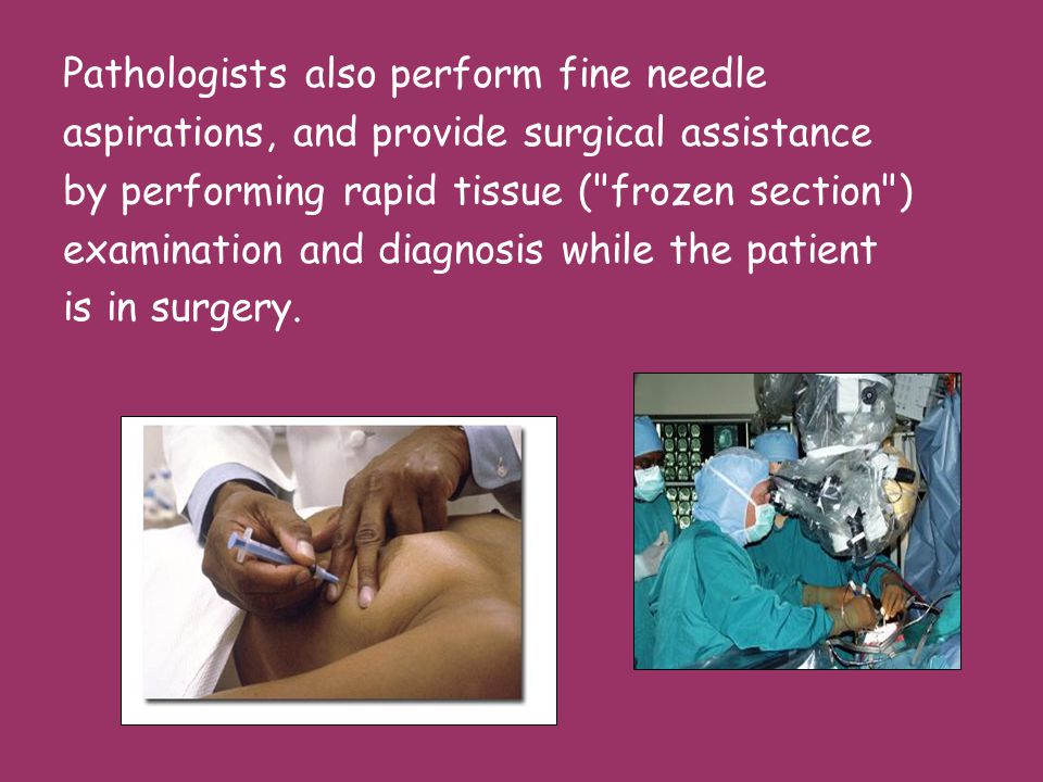 Pathologists also perform fine needle