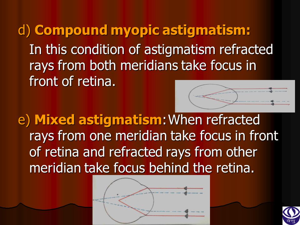myopia hyperopia and astigmatism ppt)