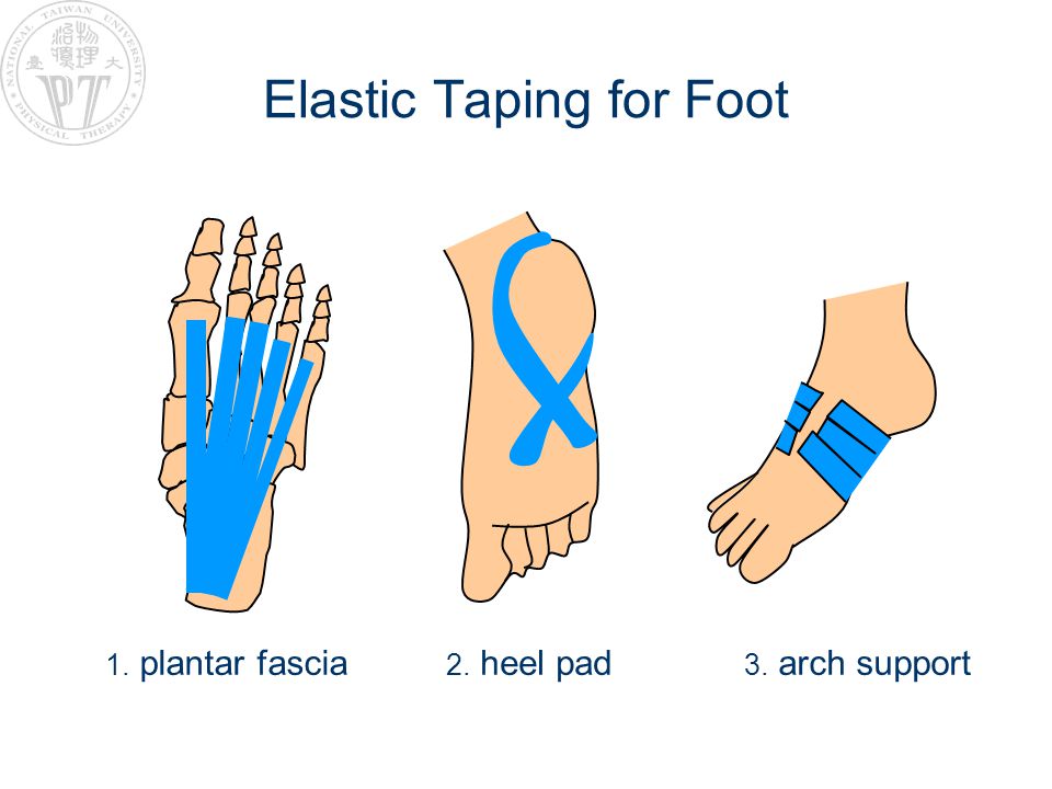 heel fat pad taping