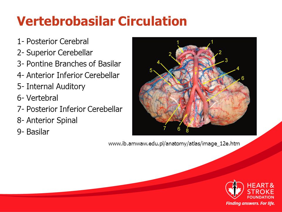 Vertebrobasilar Circulation
