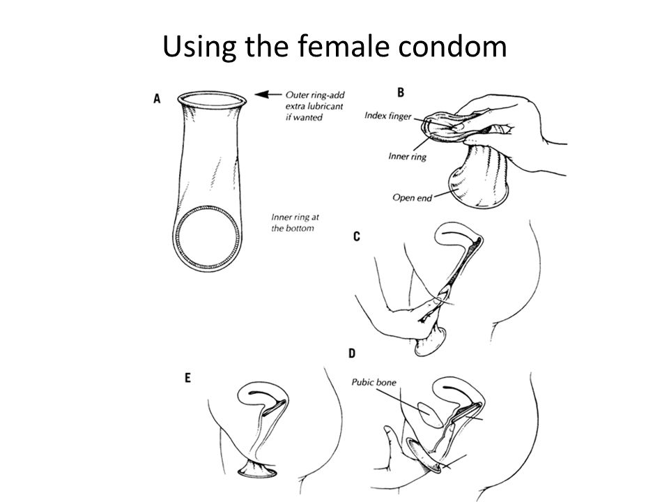 Using the female condom