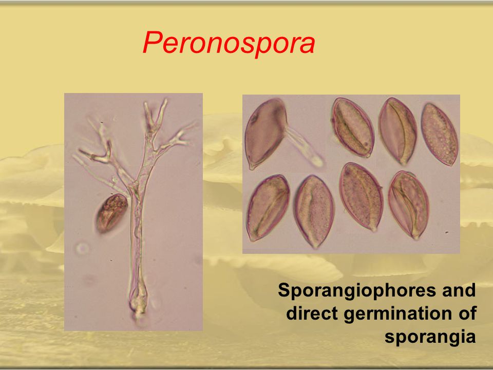 Peronospora Sporangiophores and direct germination of sporangia