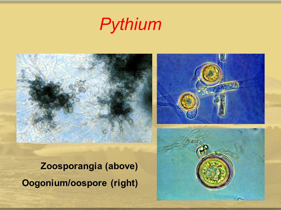 Pythium Zoosporangia (above) Oogonium/oospore (right)