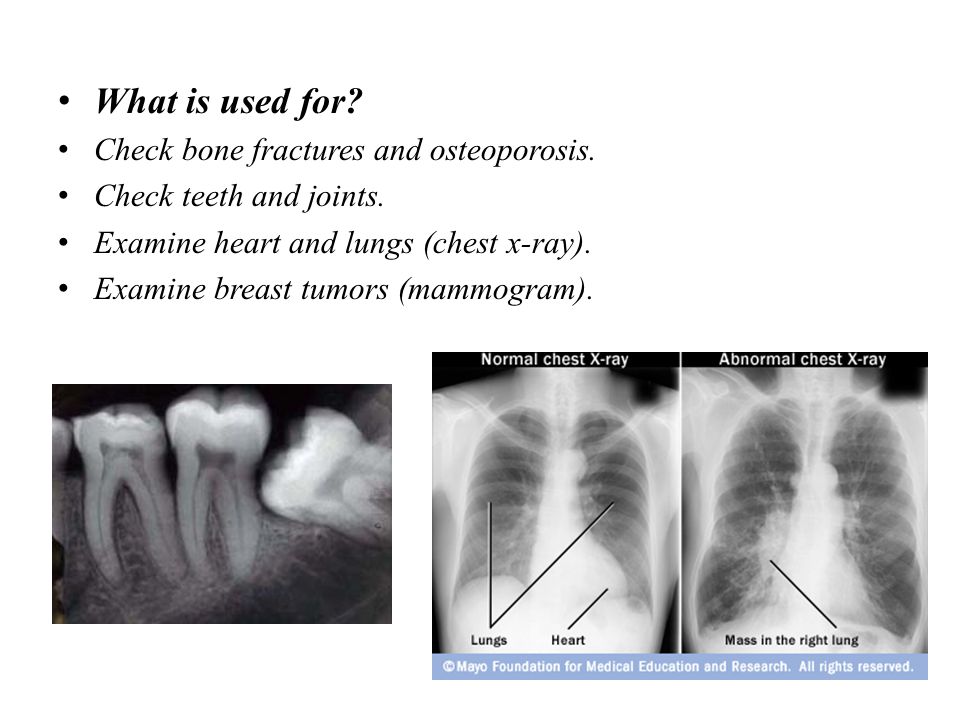 Conventional Radiography Ppt Video Online Download