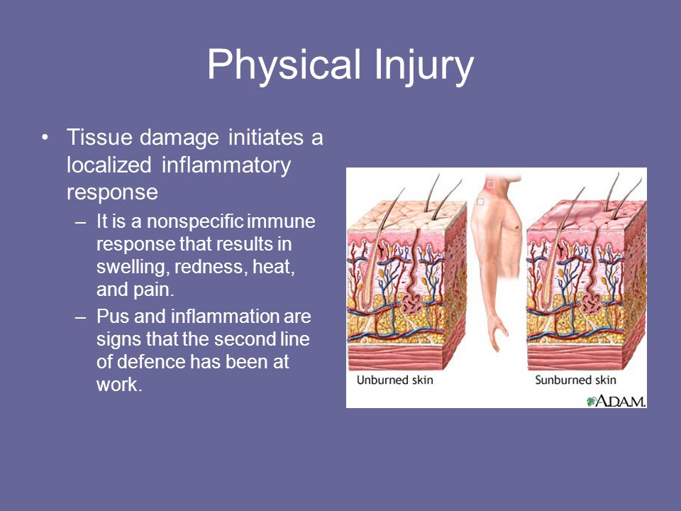Physical Injury Tissue damage initiates a localized inflammatory response.