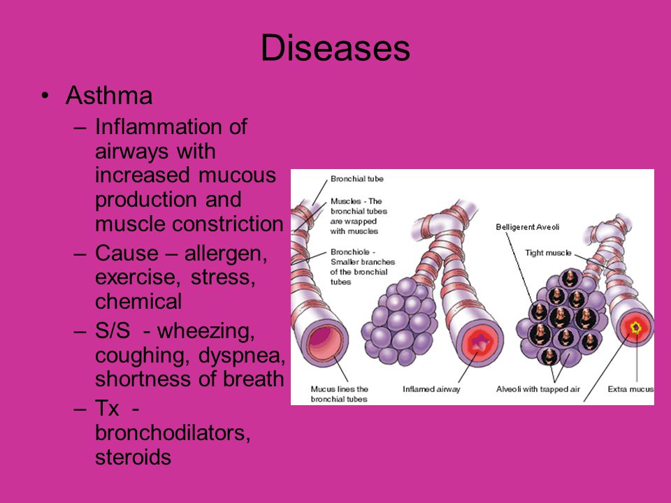 Diseases Asthma. Inflammation of airways with increased mucous production and muscle constriction.