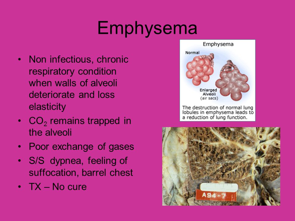 Emphysema Non infectious, chronic respiratory condition when walls of alveoli deteriorate and loss elasticity.