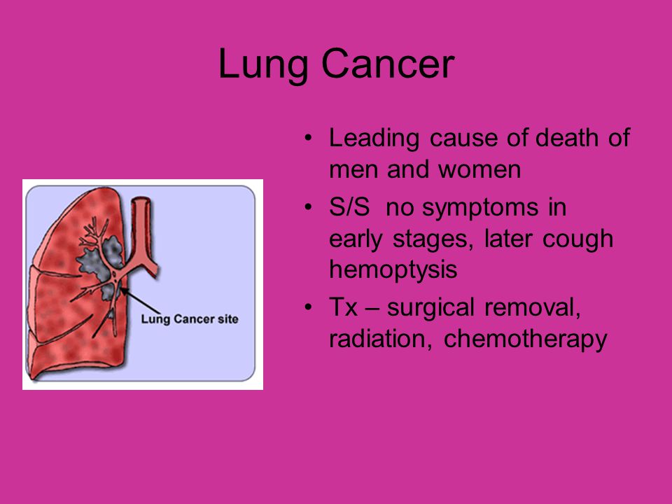 Lung Cancer Leading cause of death of men and women