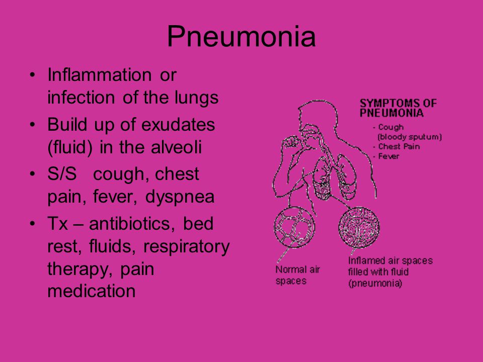 Pneumonia Inflammation or infection of the lungs