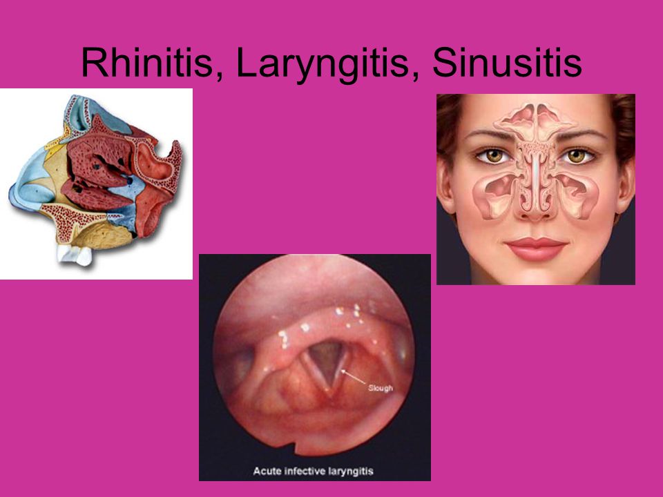 Rhinitis, Laryngitis, Sinusitis