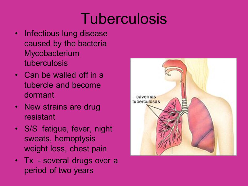 Tuberculosis Infectious lung disease caused by the bacteria Mycobacterium tuberculosis. Can be walled off in a tubercle and become dormant.
