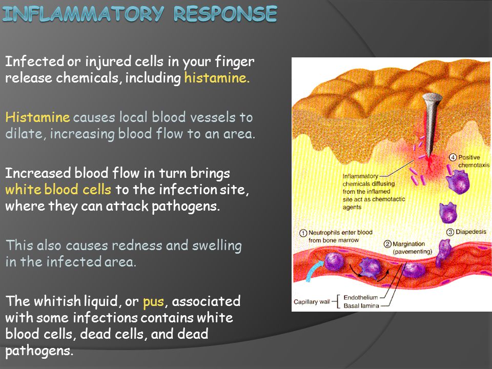 Inflammatory response