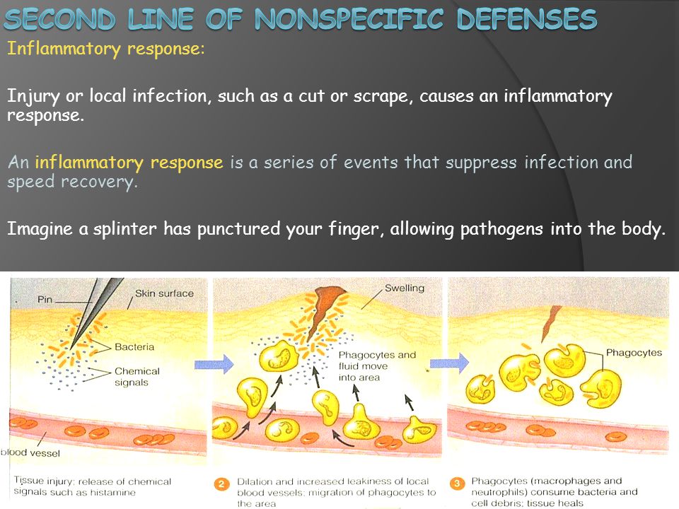 Second Line of Nonspecific defenses