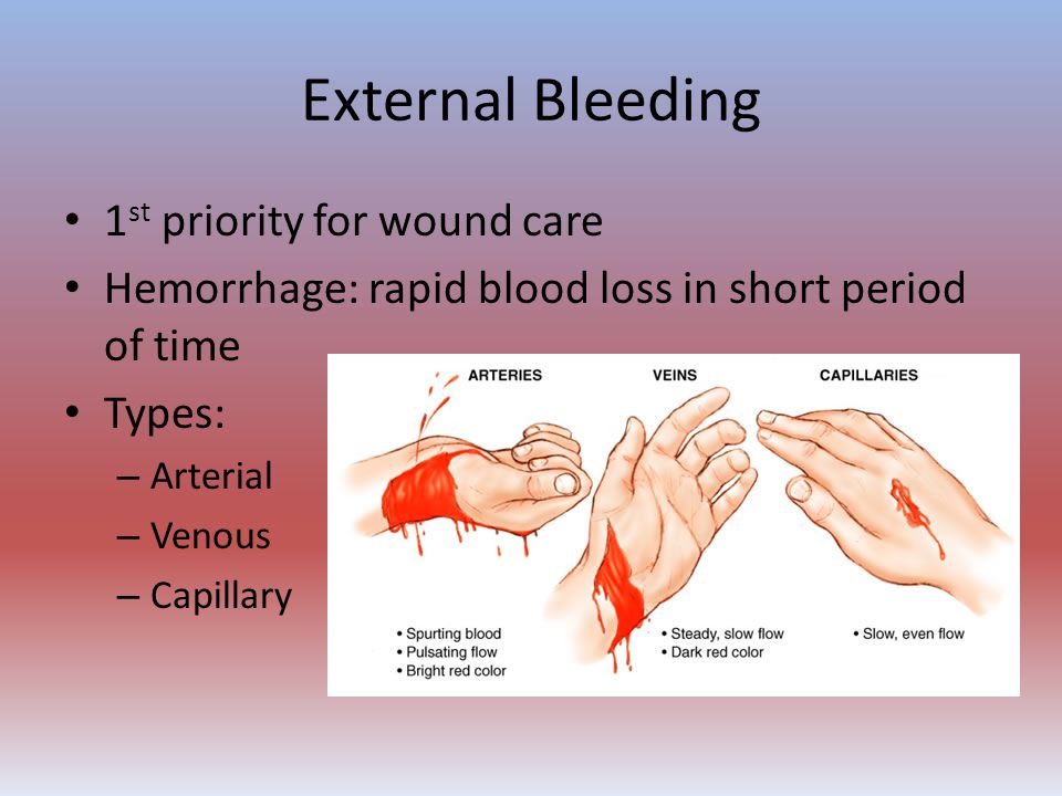 The first for time bleeding Does a
