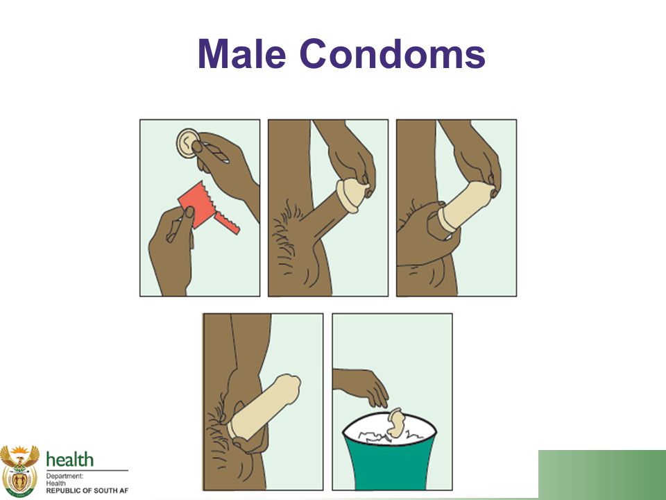 Putting on a condom uncircumcised Category:Videos of condom. 