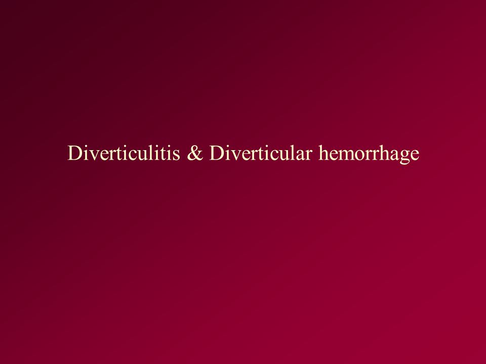Diverticulitis & Diverticular hemorrhage