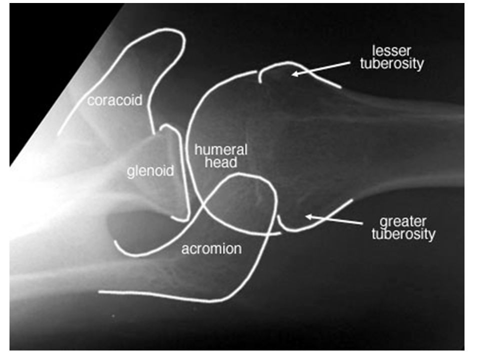 (nor removal from sling); - the patient leans backward; - the x-ray plate i...