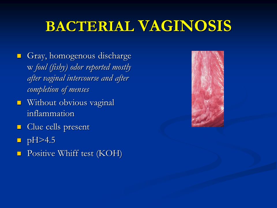 Vaginal odour during pregnancy