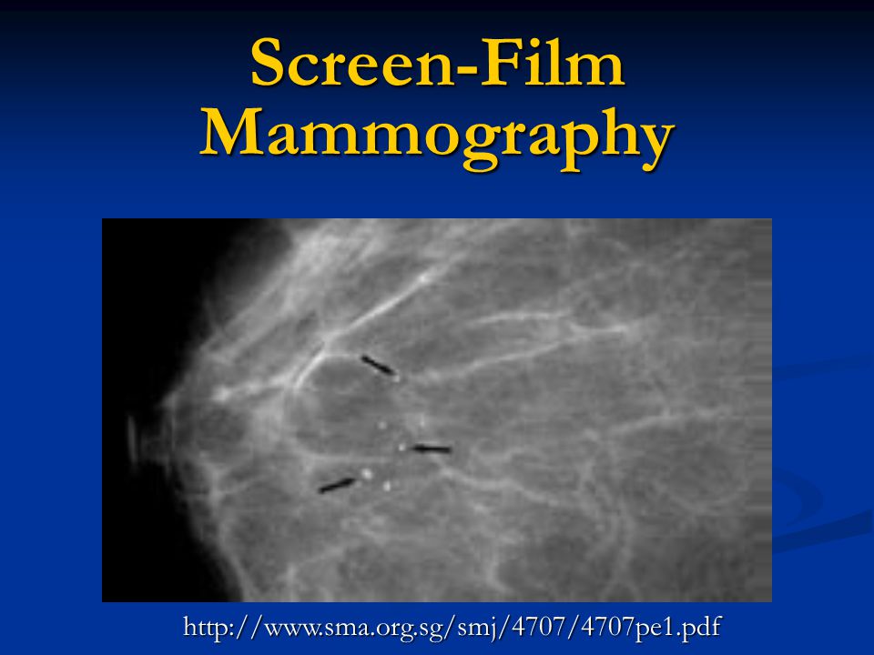 Featured image of post Grid Artifact Mammo : In step 2, in spatial domain.