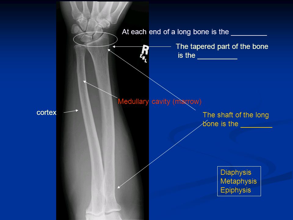 of parts long bone Extremities Imaging The the ppt Musculoskeletal System of parts long bone Extremities Imaging The the ppt Musculoskeletal System