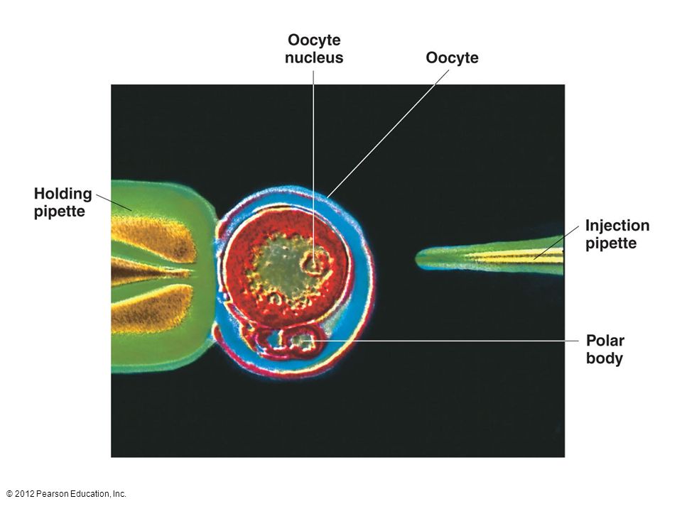 Cloned DNA can be transferred into mammals by direct injection into the oocytes.