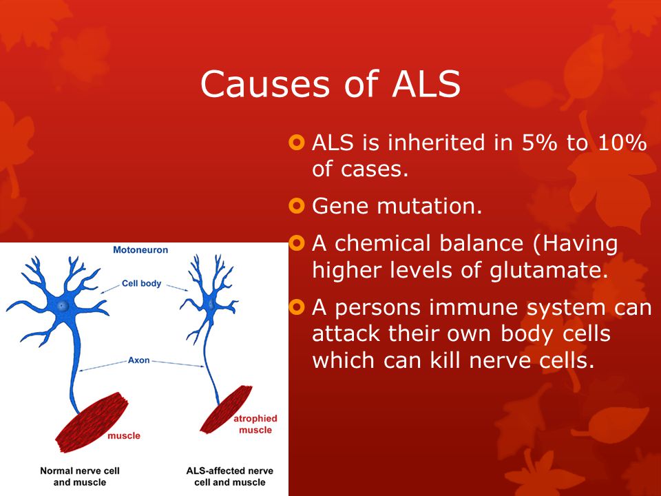 Causes of ALS ALS is inherited in 5% to 10% of cases. Gene mutation.