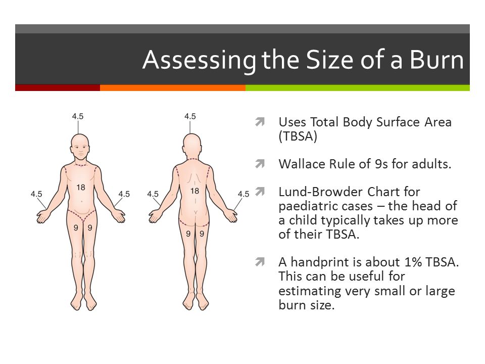 Pediatric Burn Chart