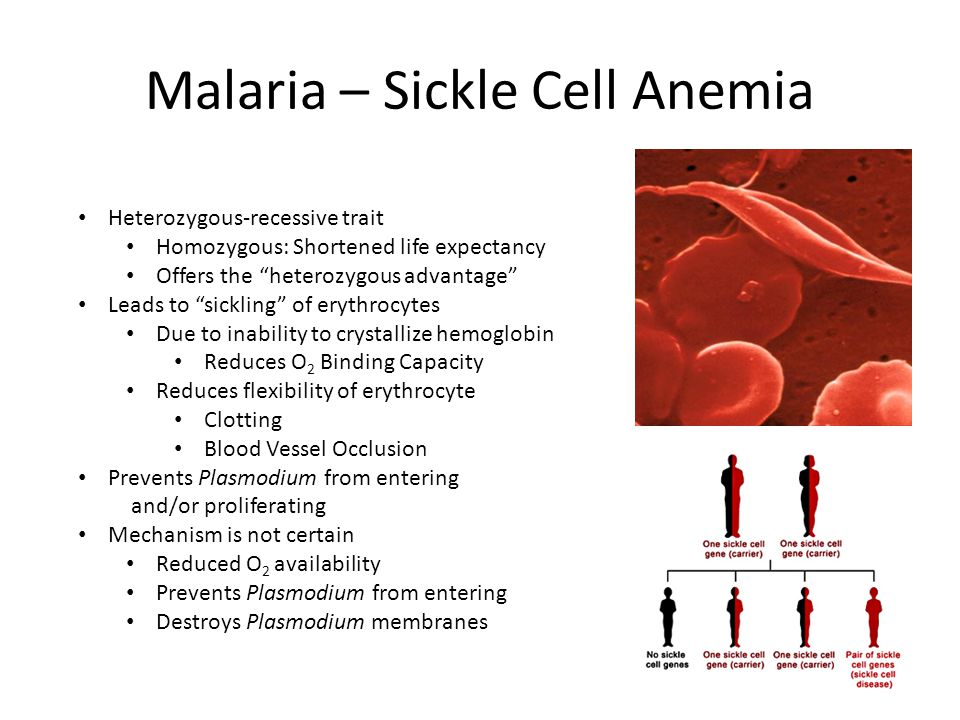 Malaria - Sickle Cell Anemia.