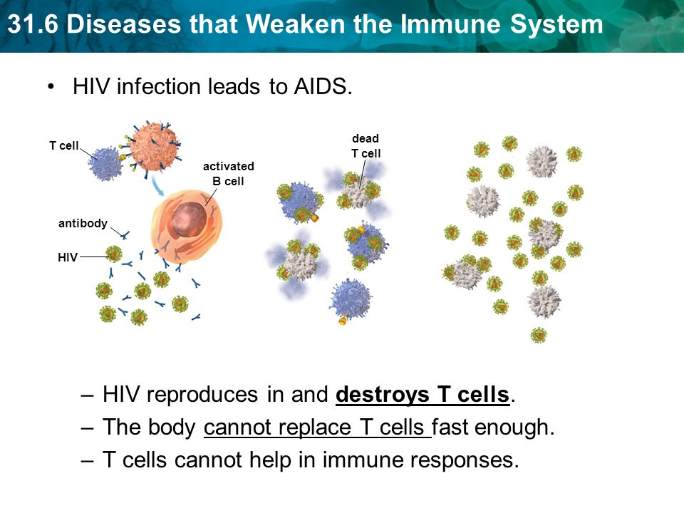 HIV infection leads to AIDS.