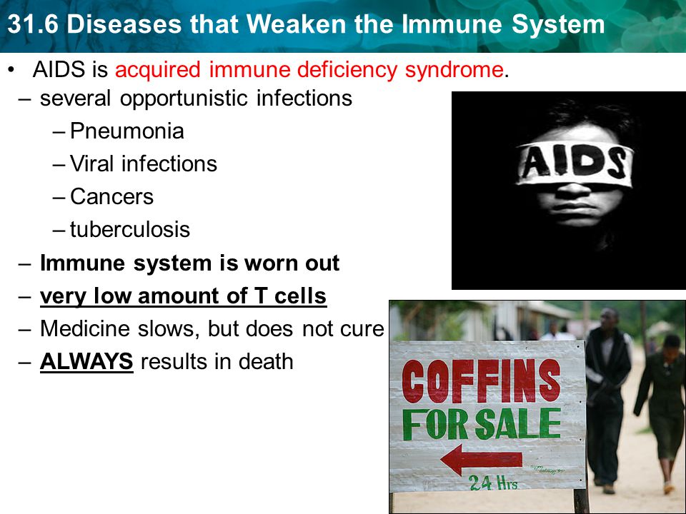 AIDS is acquired immune deficiency syndrome.