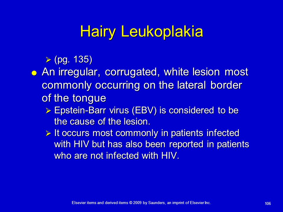 Hairy Leukoplakia (pg. 135) An irregular, corrugated, white lesion most commonly occurring on the lateral border of the tongue.