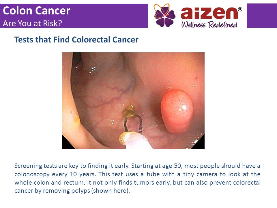 Colon Cancer Are You at Risk Tests that Find Colorectal Cancer