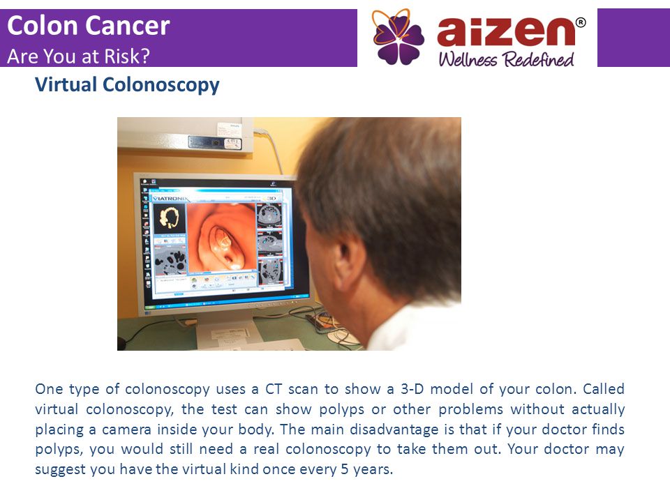 Colon Cancer Are You at Risk Virtual Colonoscopy