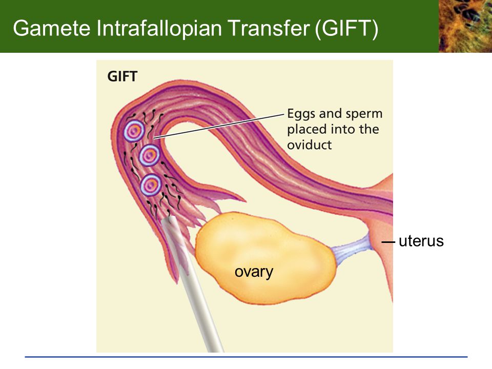 Angie Writen Report  PDF  In Vitro Fertilisation  Assisted Reproductive  Technology