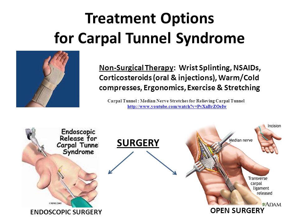 Carpal Tunnel : Median Nerve Stretches for Relieving Carpal Tunnel. 