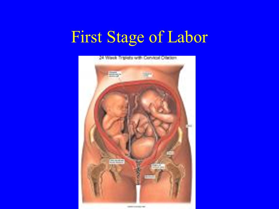 First Stage of Labor