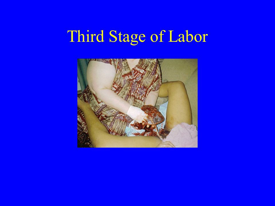 Third Stage of Labor