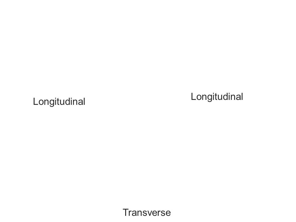 Longitudinal Longitudinal Transverse