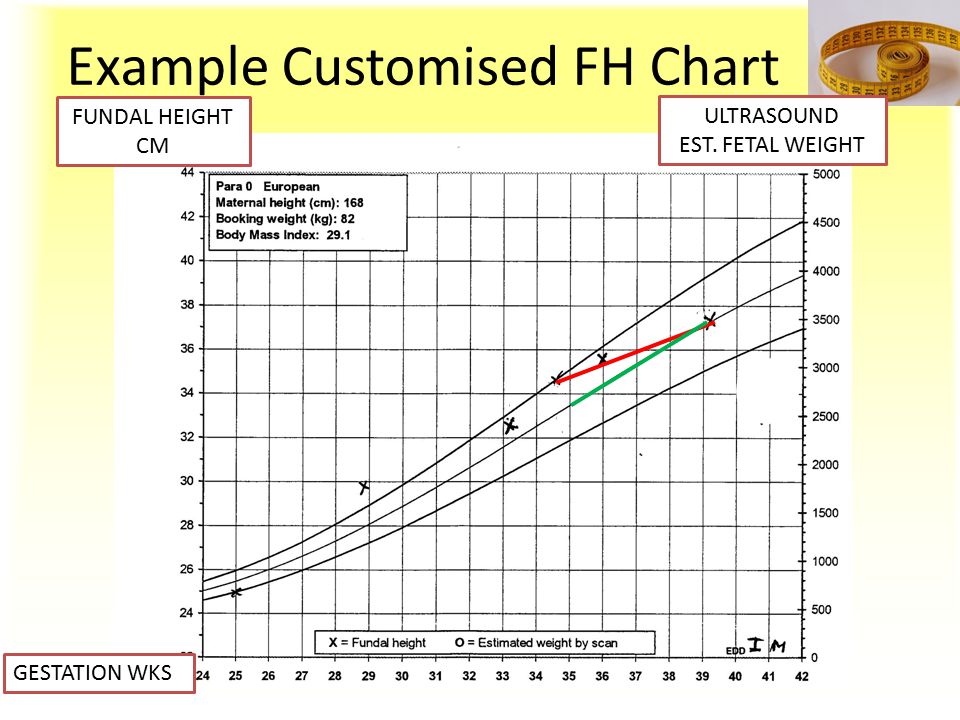 Fundal Height Chart In Cm