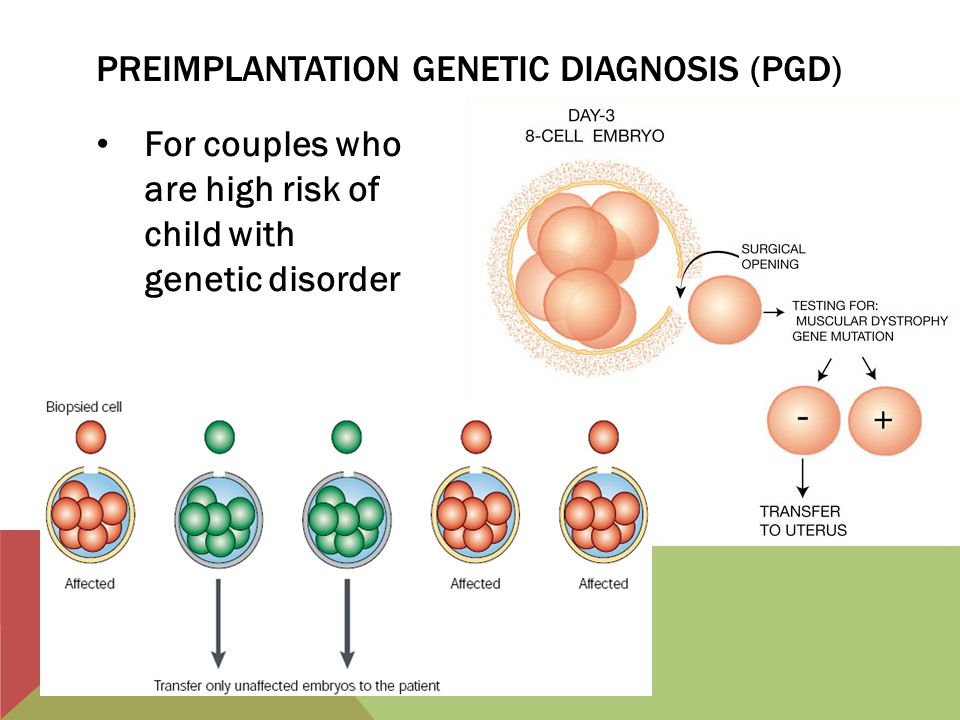 Preimplantation genetic diagnosis (PGD) .