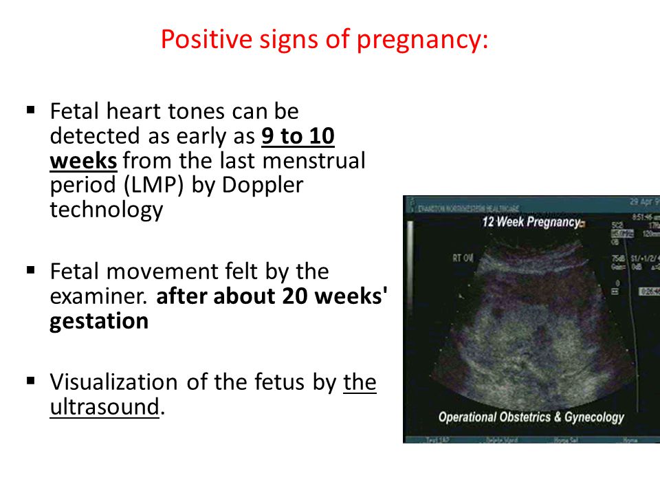 Positive signs of pregnancy: