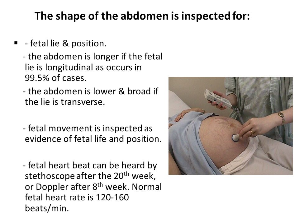 The shape of the abdomen is inspected for: