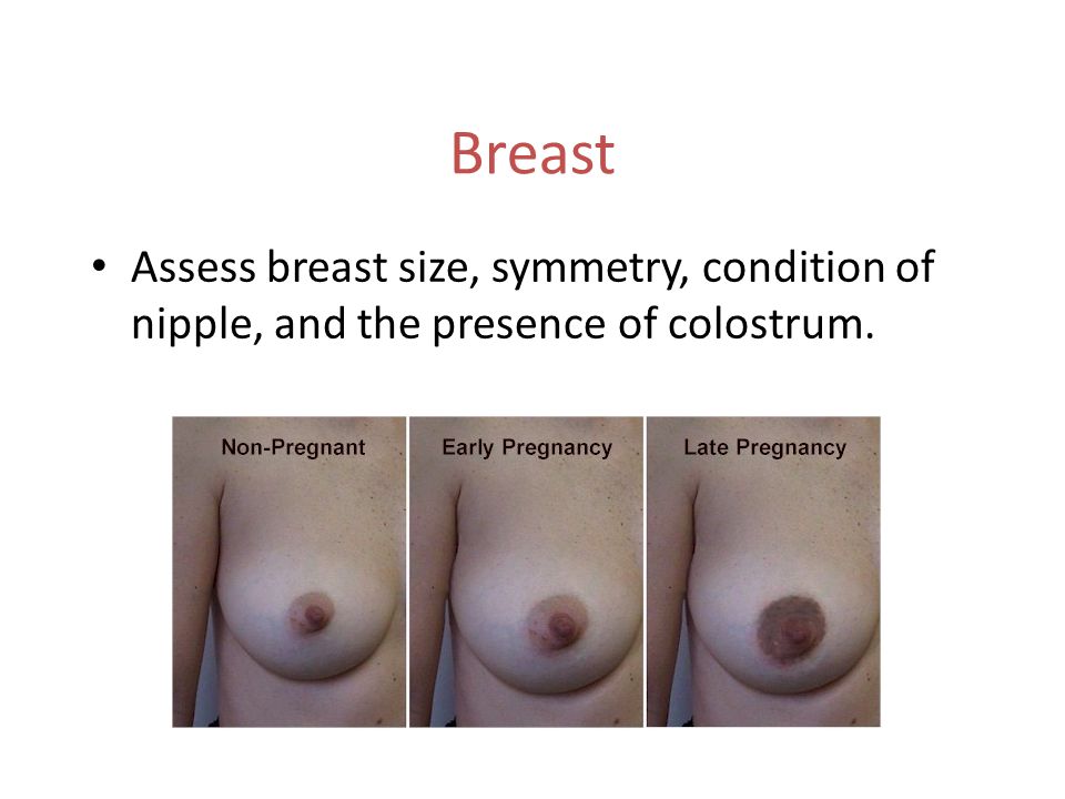 Breast Assess breast size, symmetry, condition of nipple, and the presence of colostrum.