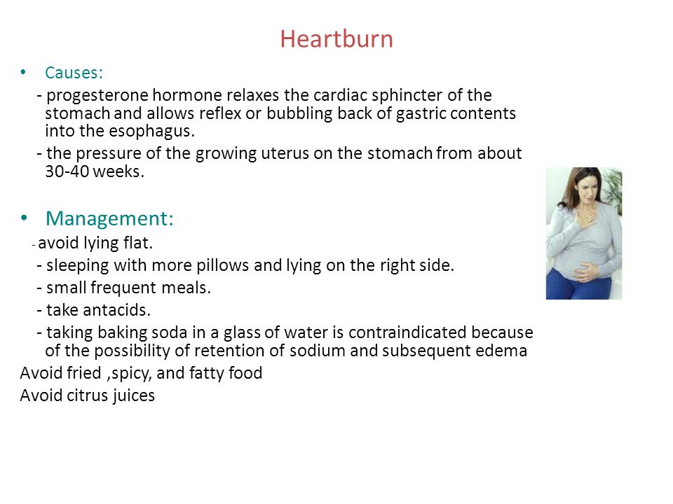 Heartburn Management: Causes: